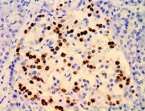 IHC of Islet on a FFPE Pancreas Tissue